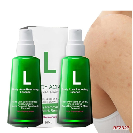 2 قطعة من مصل علاج حب الشباب وإزالة البثور RF2327-FD